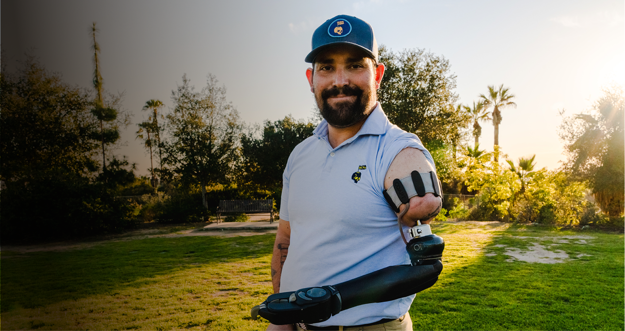 Picture of OPRA™ Implant System patient on golf course