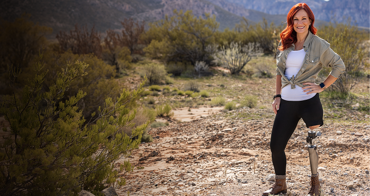 An OPRA™ Implant System patient standing in natural landscape.