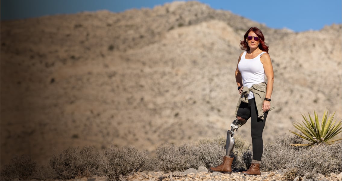 An OPRA™ Implant System patient standing in natural landscape.