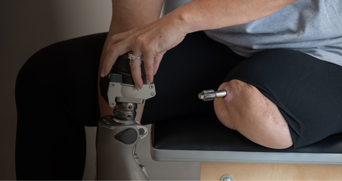 Пацієнтка із OPRA™ Implant System, яка займається йогою.