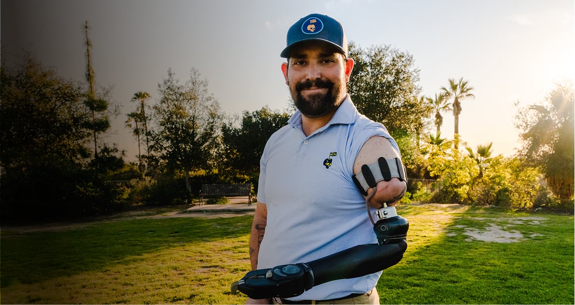 Picture of OPRA™ Implant System patient on golf course