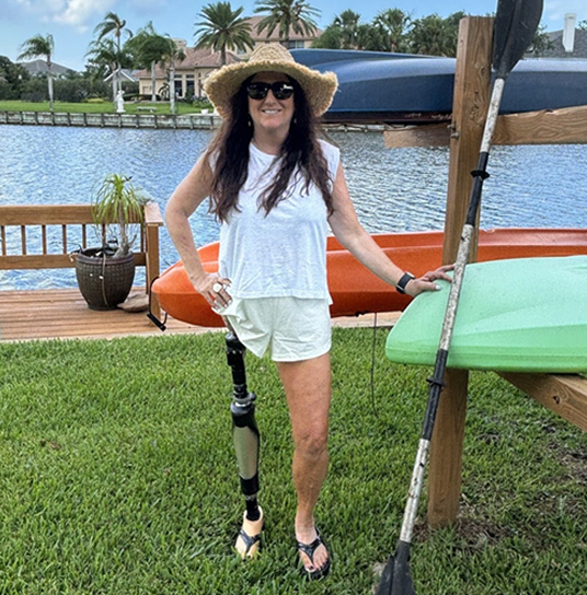 An OPRA™ Implant System patient standing near water with kayak.