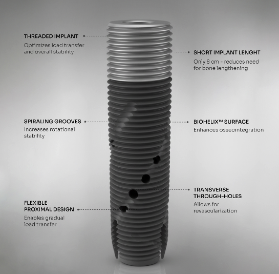 Detailed diagram of OPRA™ Implant System.