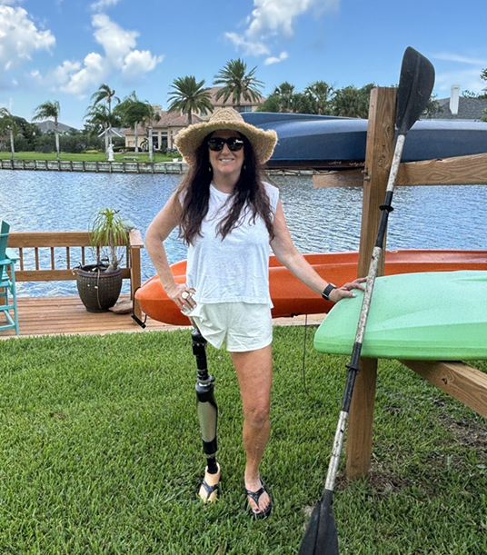 An OPRA™ Implant System patient standing near water with kayak.